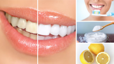 Cách Làm Trắng Răng Tại Nhà Hiệu Quả – Dễ Thực Hiện Và An Toàn